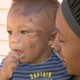 Illustration for article titled Milwaukee Daycare Says 8-Month-Old Got Bit by a Mosquito; Injuries Point to Abuse